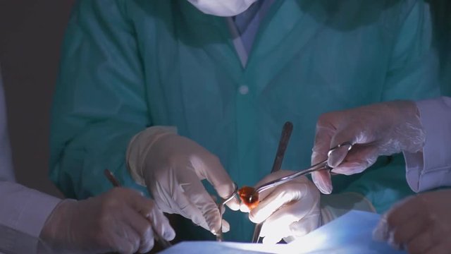 Surgeons team preforming operation in hospital operating theater, close up face. Surgeon operating patient,wearing surgical mask.