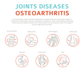 Joints diseases. Arthritis, osteoarthritis symptoms, treatment icon set. Medical infographic design - obrazy, fototapety, plakaty