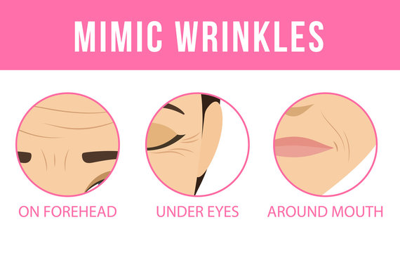 Different types of facial wrinkles. Age-related skin changes. Vector