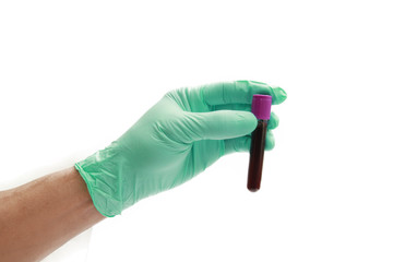 Hand of a doctor holding a bottle of blood sample