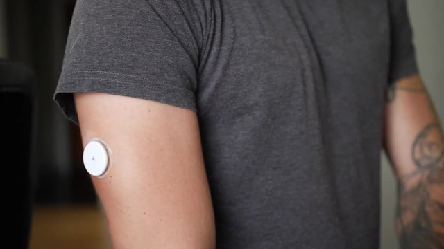 A young man with diabetes checks his blood glucose levels in his home with his smartphone and glucose reading sensor on his arm.