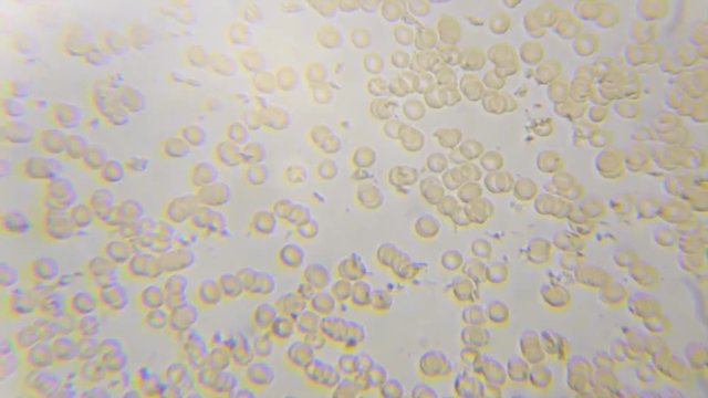 Clotting / Coagulation process of the human blood, time lapse, under microscope magnification 400 times