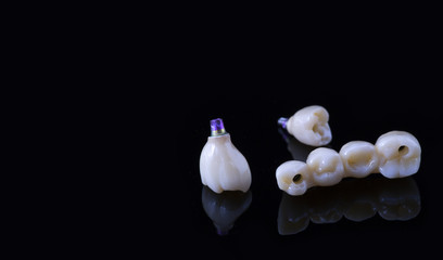 Tooth human implant. Dental concept. Ceramic human teeth or dentures. Implants on black background closeup