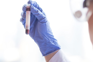 Professional doctor or lab technician in medical blue glove, goggles, white gown uniform holding blood sample with copyspace, copy space for adding diseases on tube , medical and health care concept.