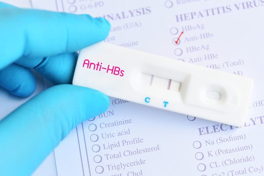 Detection of Anti-HBs (Hepatitis B antibody) by using rapid test cassette, the result showed positive