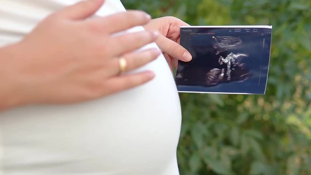 Pregnant woman holding ultrasound scan, photo or picture on the belly of her future daughter or son in the arms. Girl expecting newborn. Motherhood concept. Baby Shower.