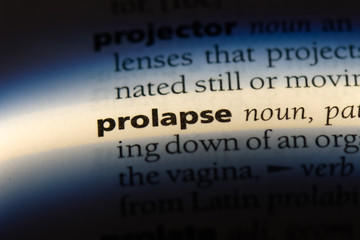 prolapse