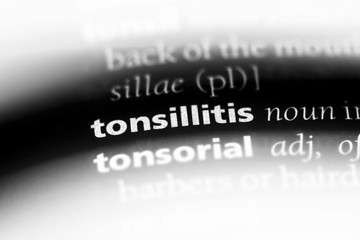 tonsillitis