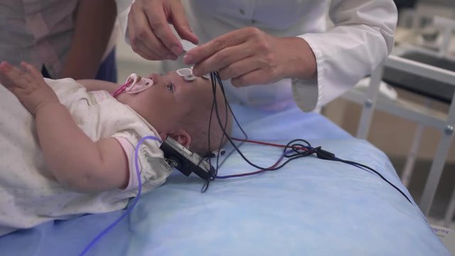 Child with a pacifier in his mouth and medical sensors on head