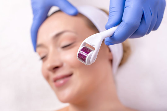 Portrait of beautiful woman in beauty salon during mesotherapy procedure with derma roller