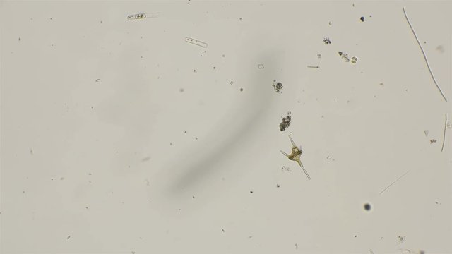 Ceratium unicellular algae, under a microscope