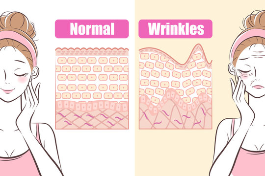 woman with wrinkles problem