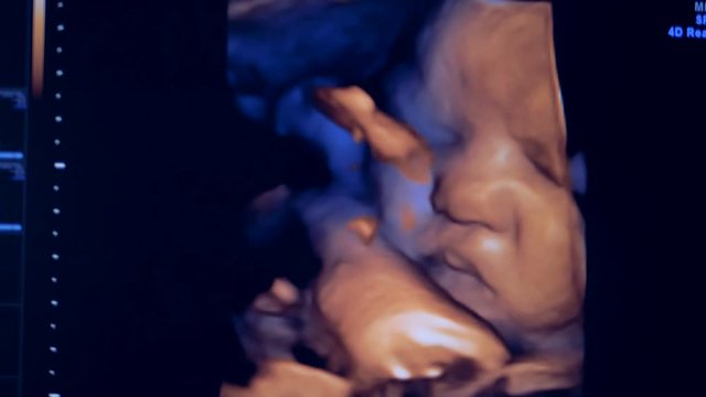 Close up of an ultrasound image of a baby. Real image of a unborn in the womb.