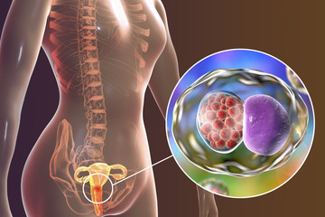 Female chlamydiosis, medical concept. 3D illustration showing close-up view of Chlamydia trachomatis bacteria infecting cells of cervix uteri - obrazy, fototapety, plakaty