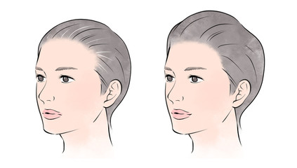 髪が薄い女性と豊かな女性