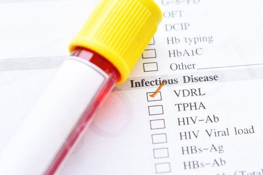 Blood sample tube with laboratory requisition form for VDRL test, diagnosis for syphilis infection