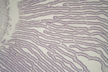 Coprinus mushroom under the microscope