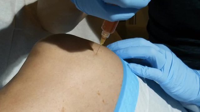 PRP Knee Injection