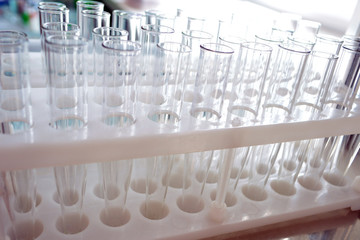 rack of blood tubes with barcode labels for proper identification and background hand of laboratory technician holding a blood tube for scan