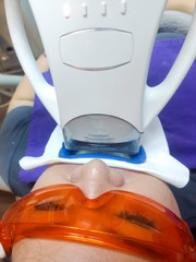 Patient with safety protective glasses and cheek retractor on. Laser light lamp in place, ready for...