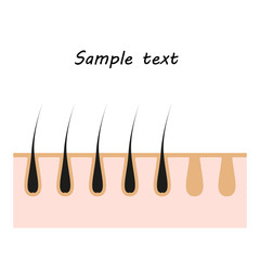 Icon illustration of skin hair. Vector element on isolated background for cosmetic depilation projects, medicine with space for text.