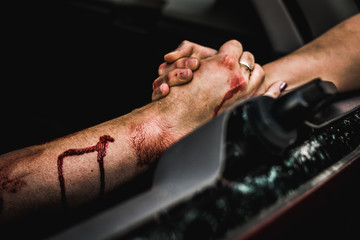 Person Clasping Injured Person's Scratched and Blood Smeared Hand