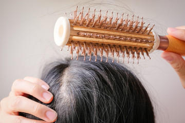 hair fall and lost alopecia woman problem on the comb.