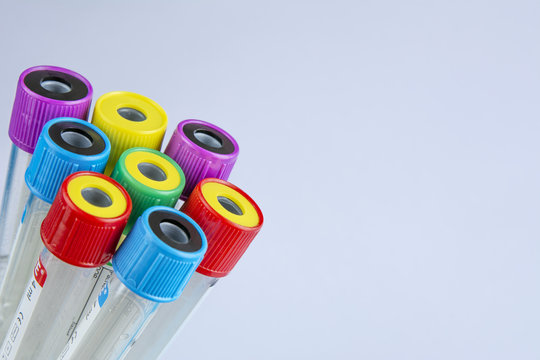 tubos de muestra de sangre aislado en blanco 