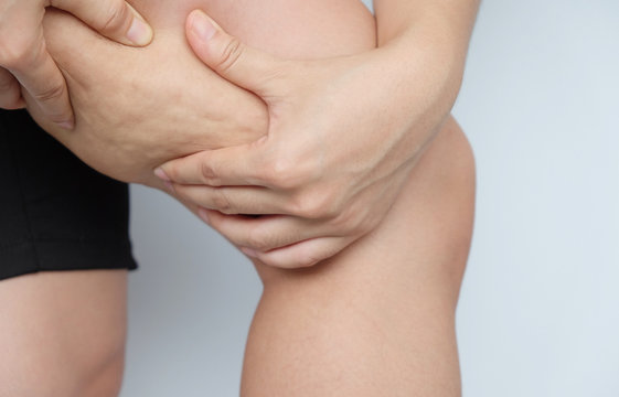 Female legs thighs with cellulite. Skin problem, body care, overweight and dieting concept, diabetic risk factor.