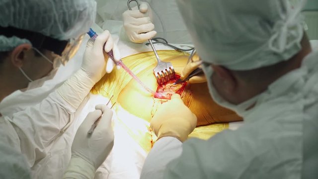 Hospital, surgery operation on the leg, surgeons at work.
