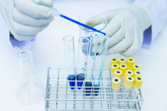 Close up. Medical or male medical in laboratory room research performs tests with blue liquid, Experimental Drug Treatment