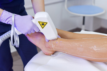 Epilation with a diode laser