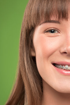 Beautiful young woman with teeth braces on green