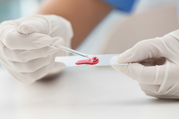 Scientist dripping blood sample on glass in laboratory