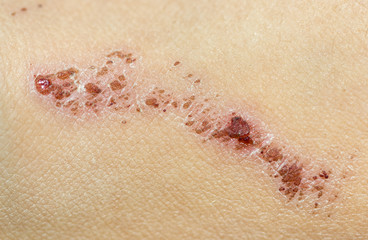 Wound on the skin of a macro