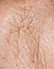 wrinkles skin old man macro