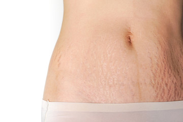 Abdominal scar marked pattern