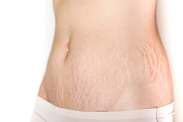 Abdominal scar marked pattern