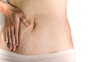 Abdominal scar marked pattern