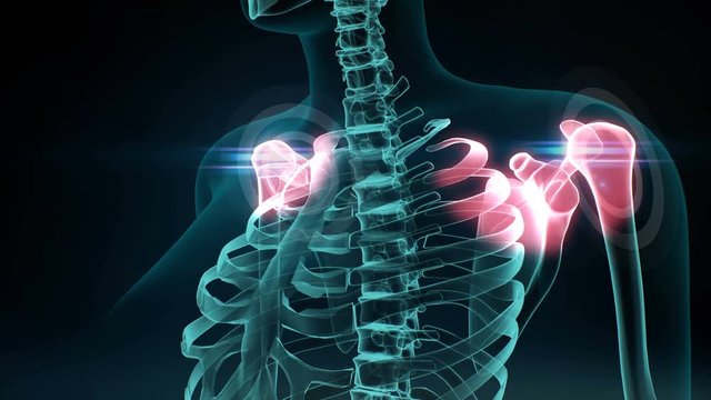 3D Illustration of painful arthritis shoulder, chest, medical concept 4k animation.2.