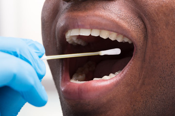 Dentist Cleaning Teeth With Cotton Buds