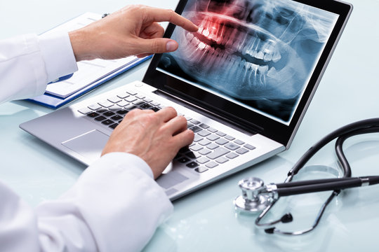 Dentist Examining Teeth X-ray On Laptop