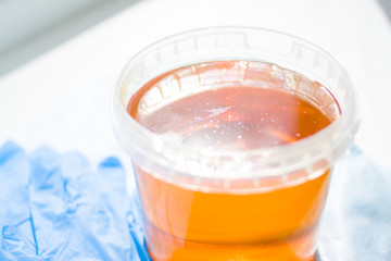 sugar paste or wax honey for hair removing - depilation and beauty concept