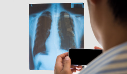 Close up of male doctor looking x-ray and smart phone isolated.medical technology concept.