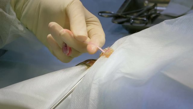 The procedure of castration. Veterinary surgeon operating a cat in a veterinary clinic. 4K