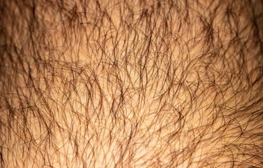 background. hairy leg fragment
