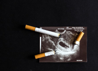 Cigarette cigarette stubs extinguished about a shot of pregnancy, pregnancy and smoking, cigarette...