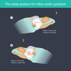The sleep posture for reflux acids symptom
