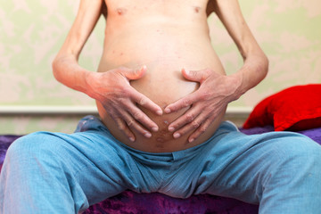 Fototapeta na wymiar ascites in man, holds his belly with his own hands