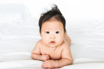 Asian baby girl with red spots on skin face